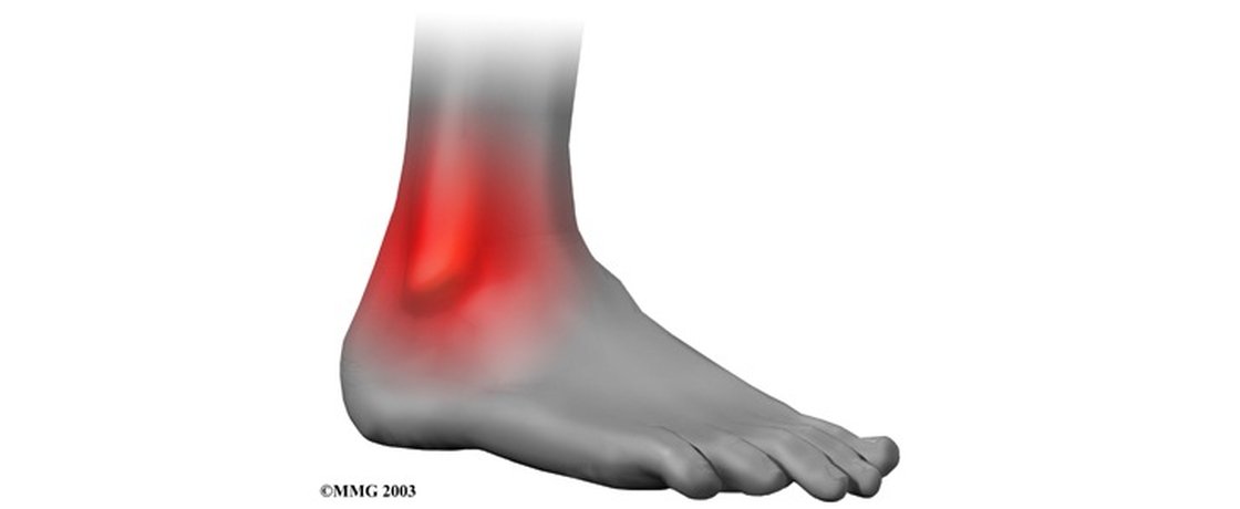 Sprained Ankle In The Wilderness